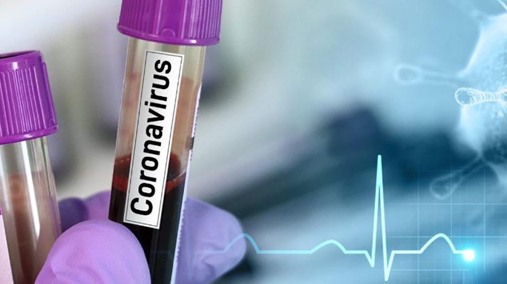 Coronavirus test